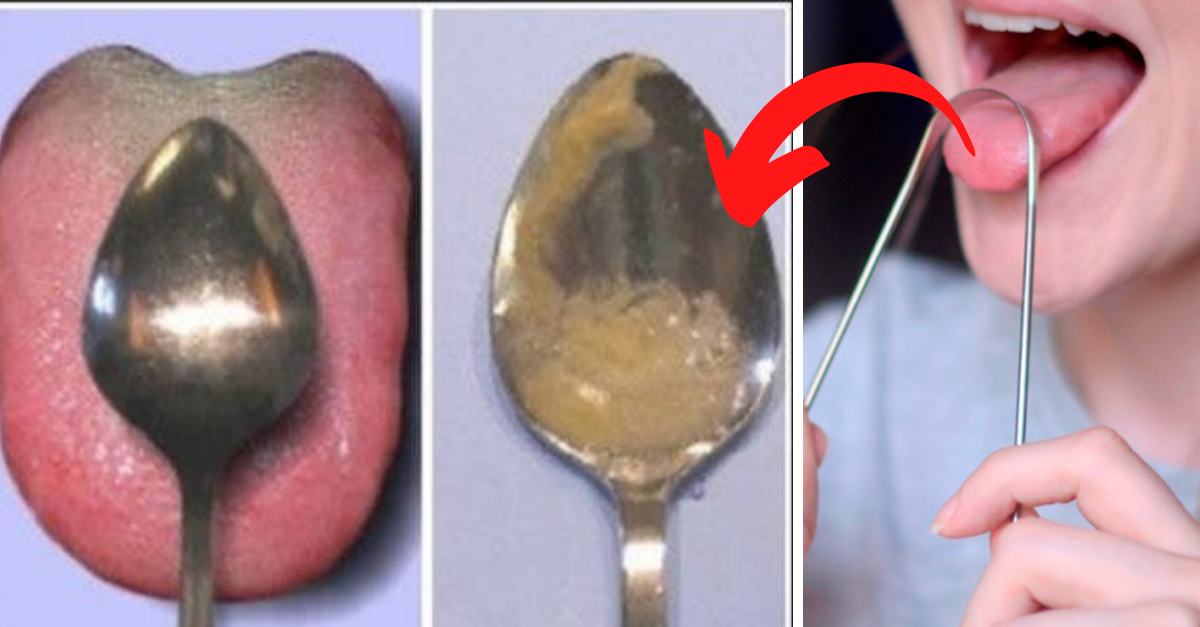 Técnica para raspar a língua: por que é importante?