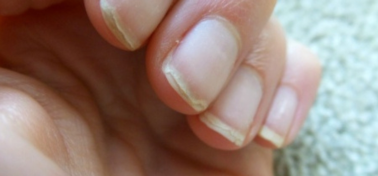 como recuperar unhas danificadas fazer massagem