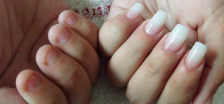 como recuperar unhas danificadas vitamina