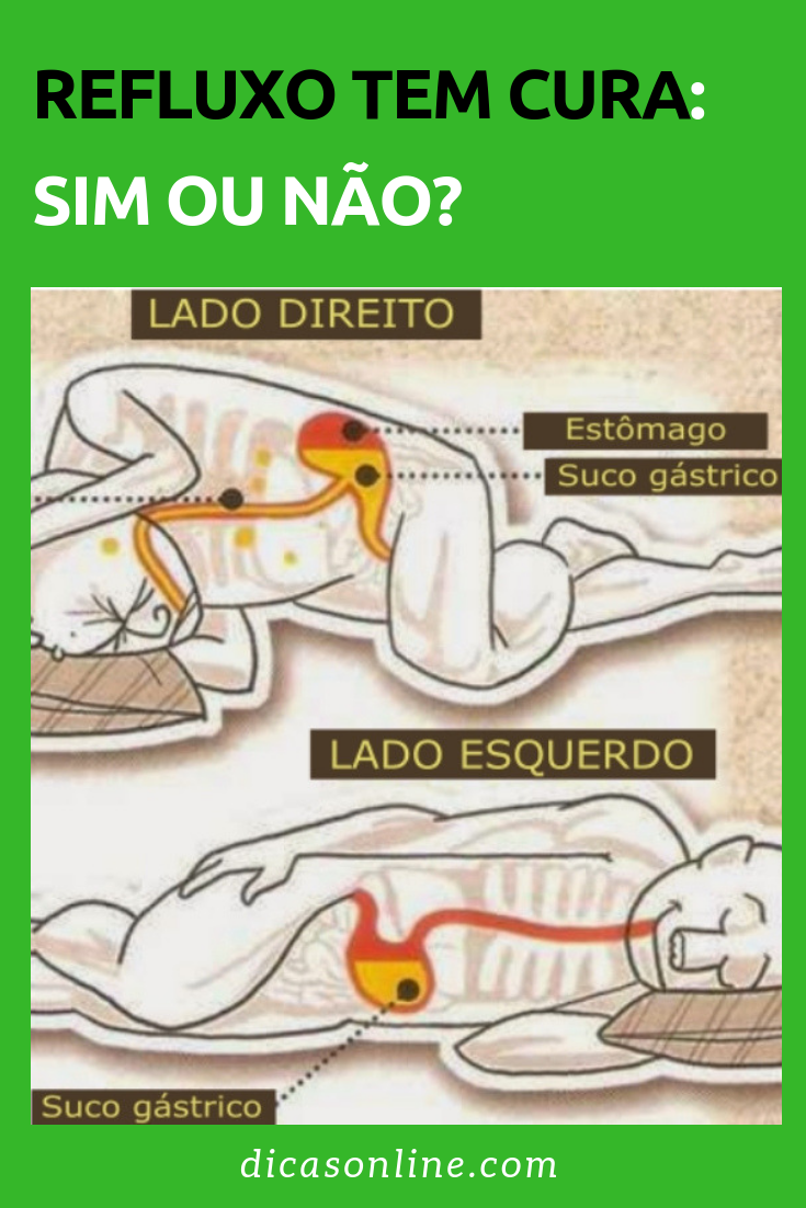 Refluxo tem cura: sim ou não