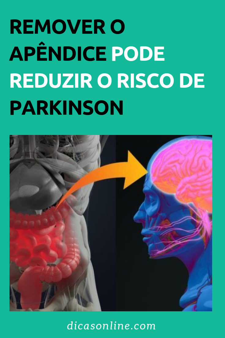 remover o apêndice