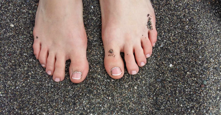 remédios caseiros para fungos nas unhas