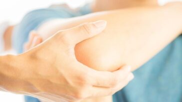 remédios para tendinite