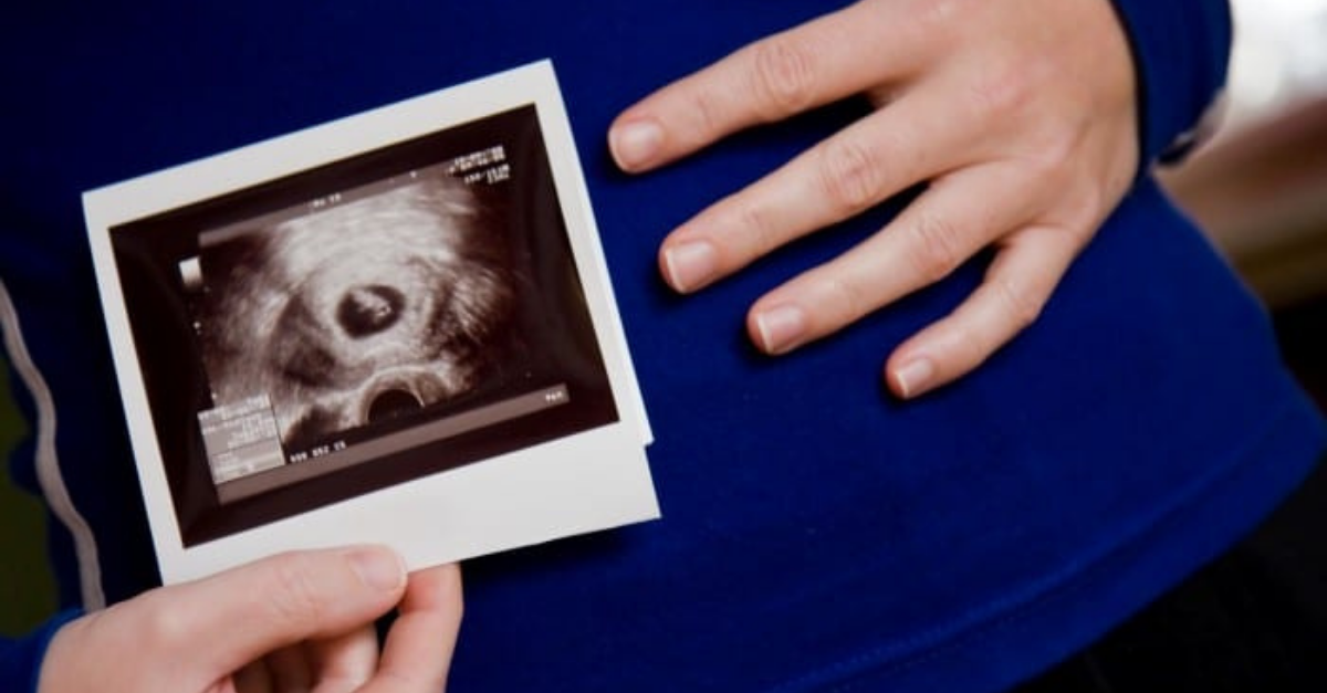Saco Gestacional Vazio Com 7 Semanas E Normal - RETOEDU