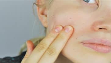 sensibilidade da pele