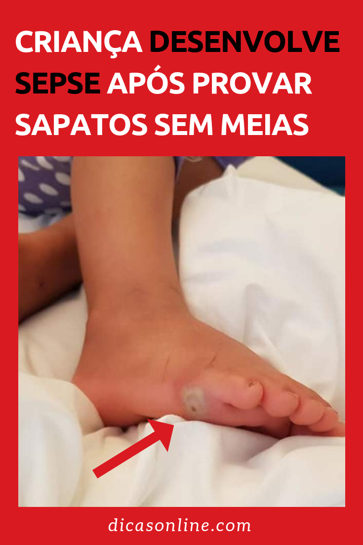 sepse após provar sapato sem meia