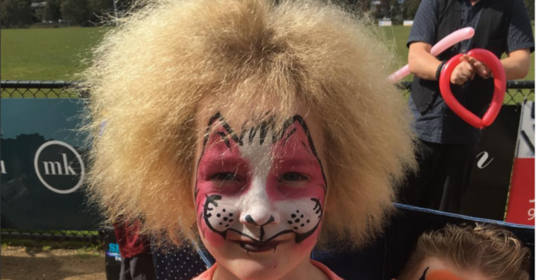 síndrome do cabelo impenteável