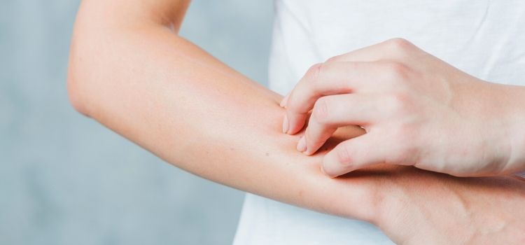 principais sintomas da alergia à bijuteria