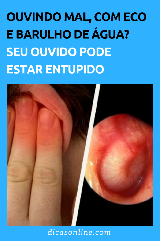 Como desentupir o ouvido