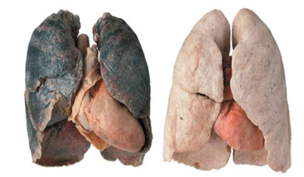 smoker-and-healthy-lungs1-copy