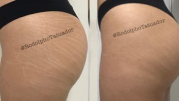 tatuagem para cobrir estrias