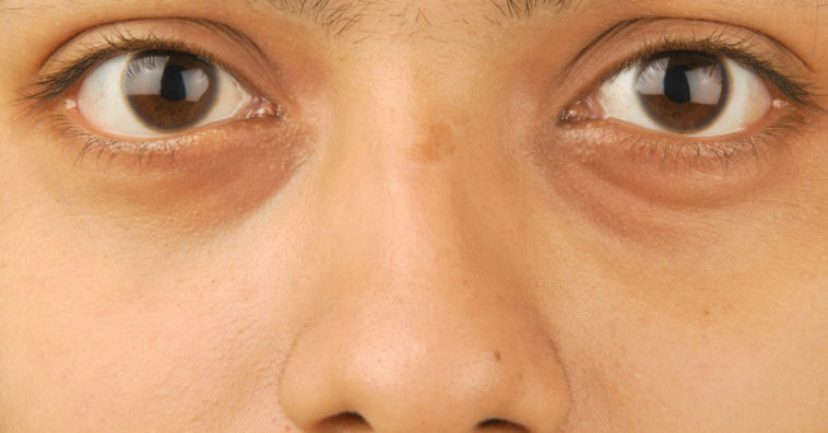 tatuagem para olheiras