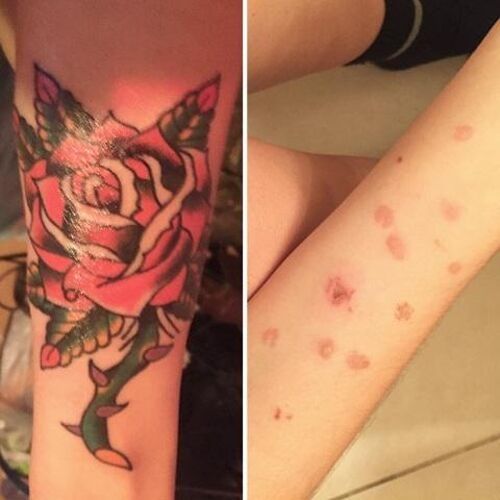 modelo tatuagem em cicatriz rosa