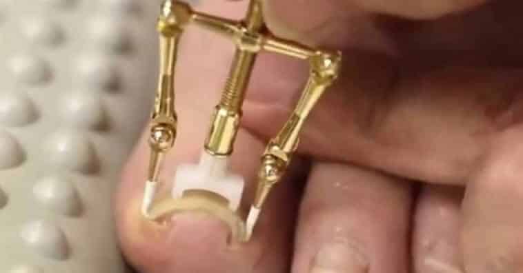 técnica japonesa para desencravar unha