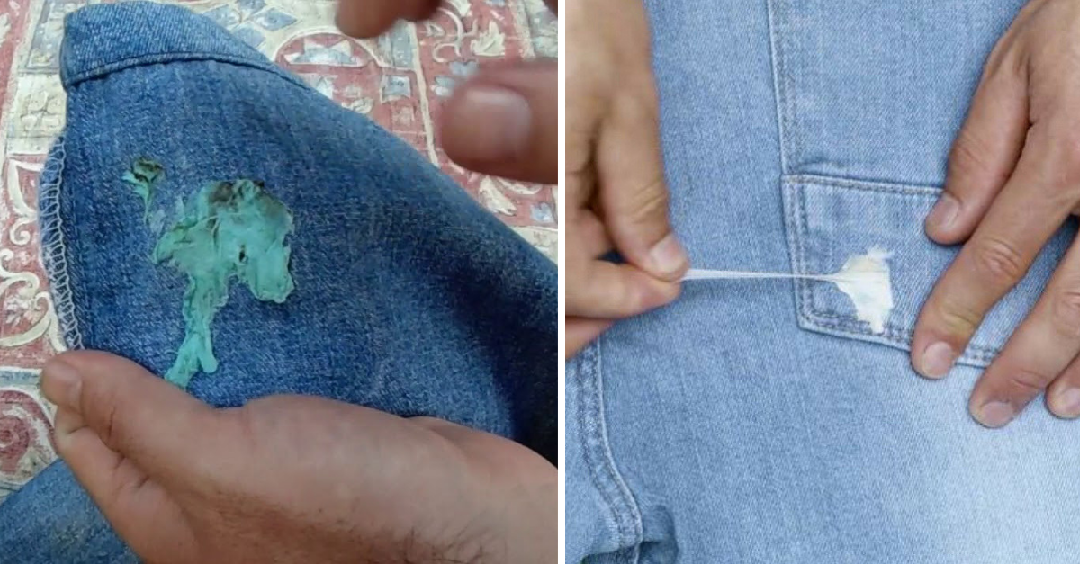 Como tirar chiclete da roupa com 15 truques fáceis