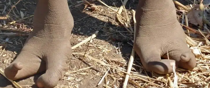 pés de avestruz