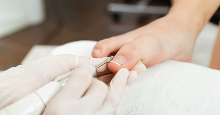 unha encravada como tratar