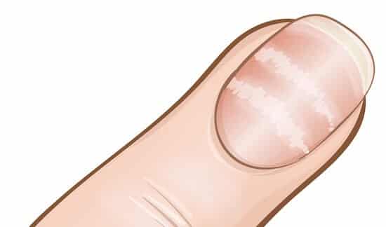 unhas podem sinalizar doenças