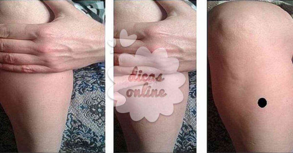 zu_san_li_2_dicas_online